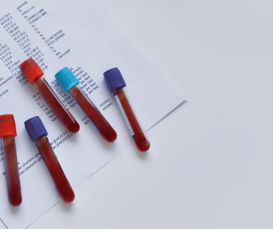Labordiagnostik: Auf dem Bild sind Ampullen zu sehen