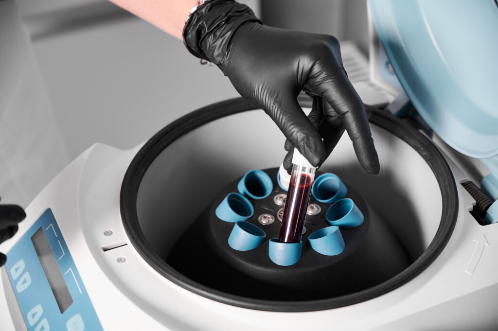Labordiagnostik Vorort